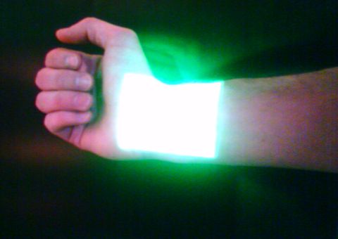 Vein Viewer on My Arm